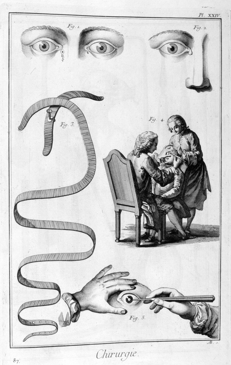 Szemsebészet, 1751-1777 alkotó: Unbekannt