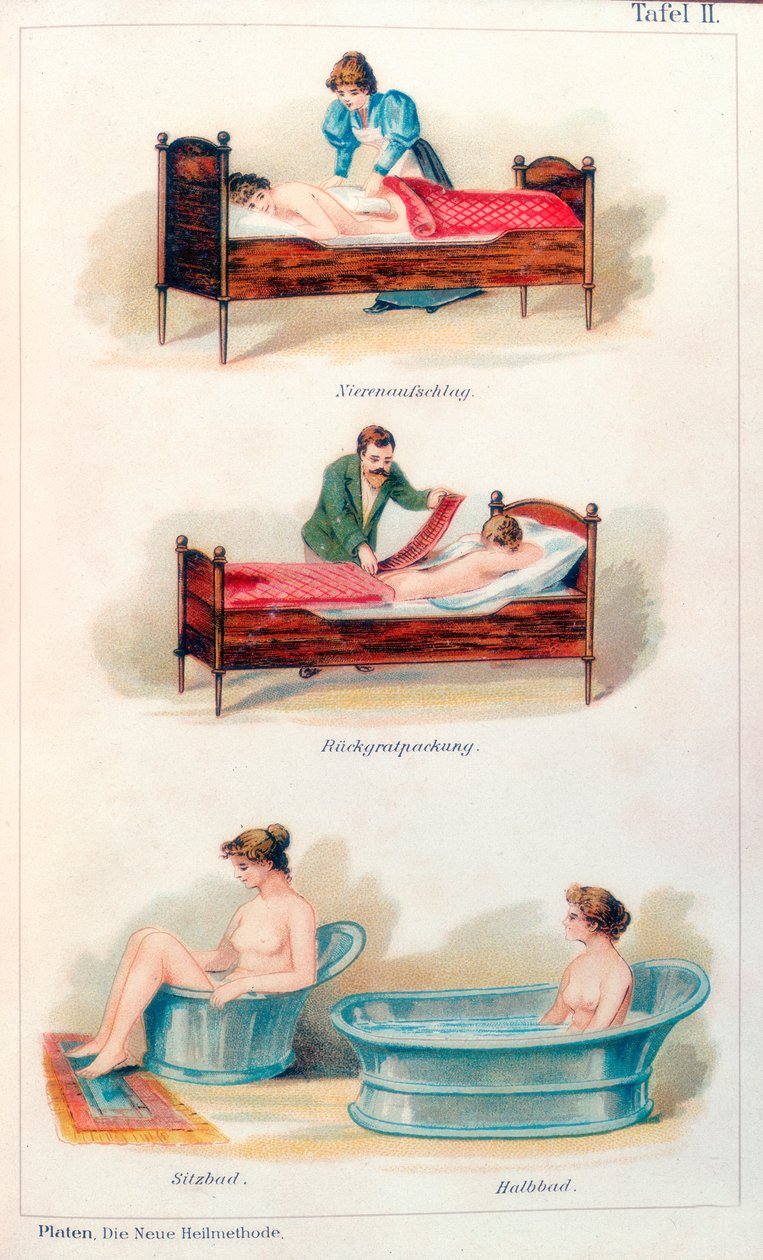 Hidroterápiás kezelések, c1902 alkotó: Unbekannt