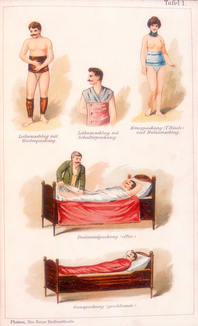 Hidroterápiás kezelések, c1902 alkotó: Unbekannt