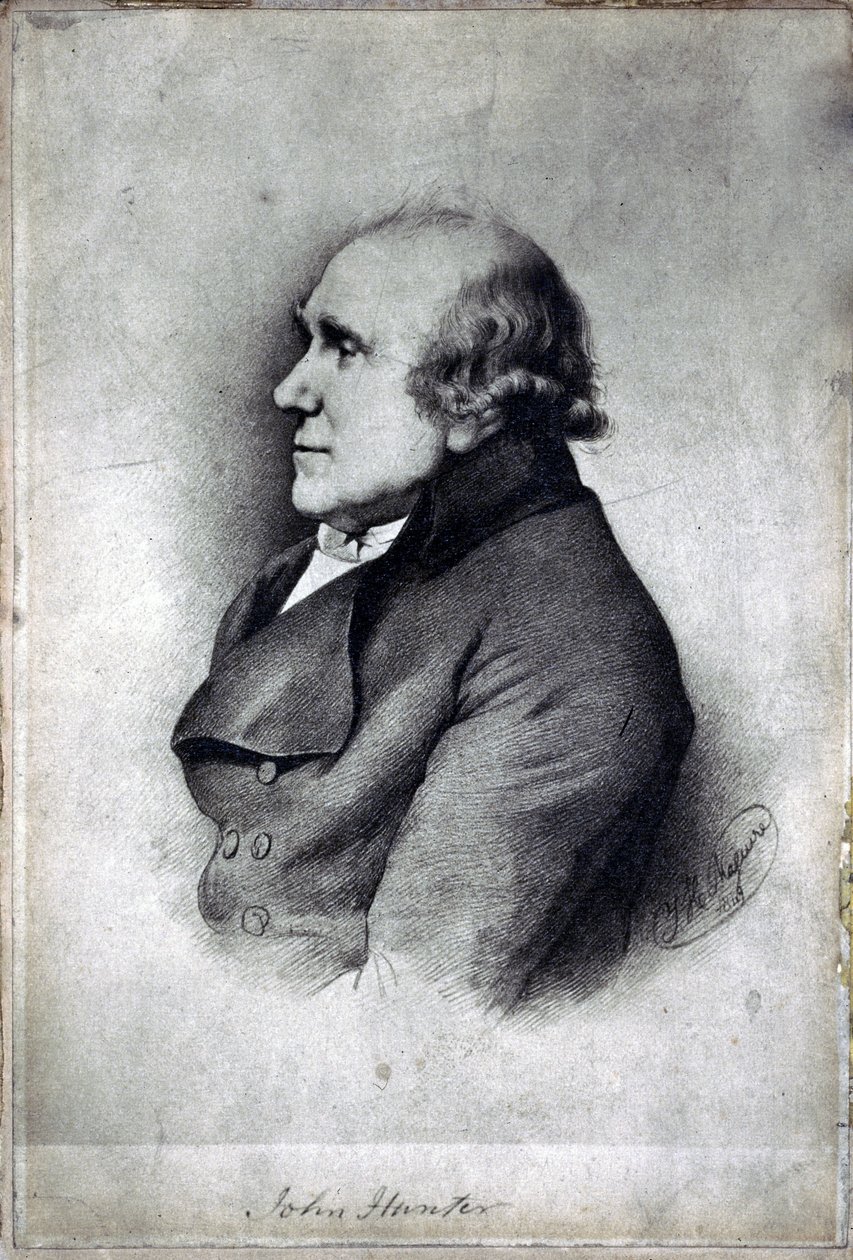 John Hunter brit sebész és anatómus, 1770 körül alkotó: Unbekannt