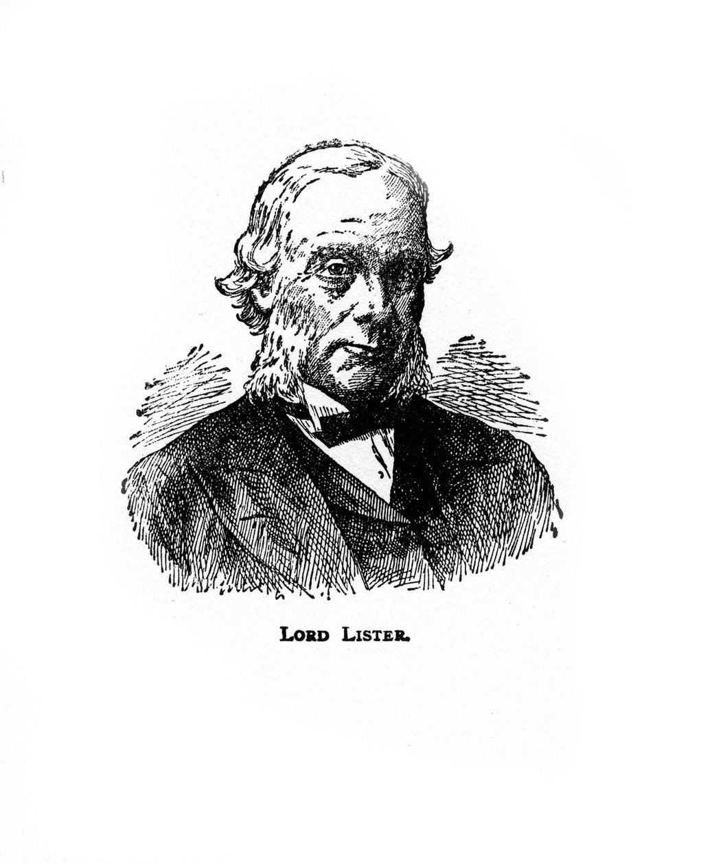 Joseph Lister, brit sebész, XX. század alkotó: Unbekannt