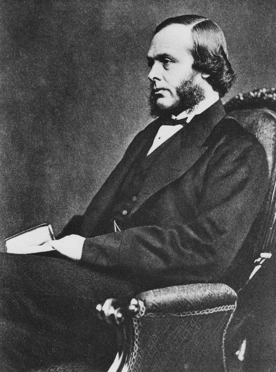 Joseph Lister angol sebész és az antiszeptikus sebészet úttörője, 1867 alkotó: Unbekannt