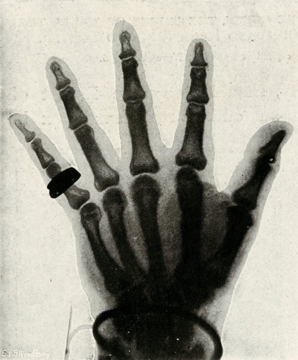 H.R.H. kezének röntgenfelvétele A walesi herceg, 1897 alkotó: Unbekannt