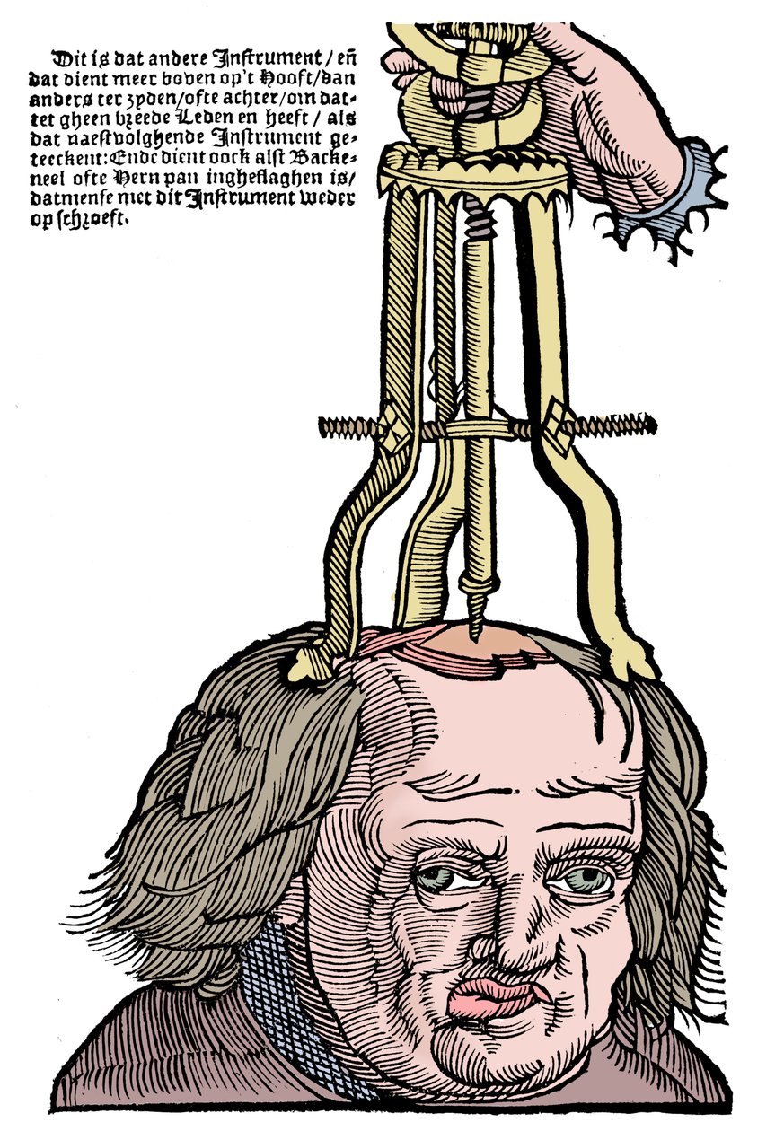 Trefinálás, 1593 alkotó: Unbekannt
