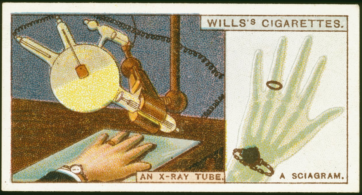 A kéz röntgenfelvétele, 1924 alkotó: Unbekannt