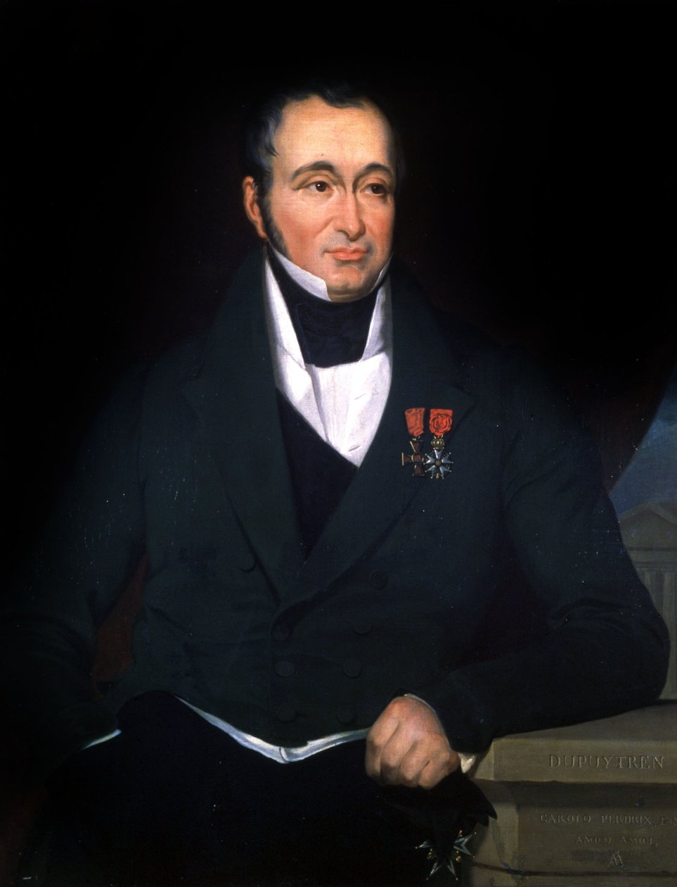 A Dupuytren doktor, 1820 körül (festmény) alkotó: Unbekannter Künstler
