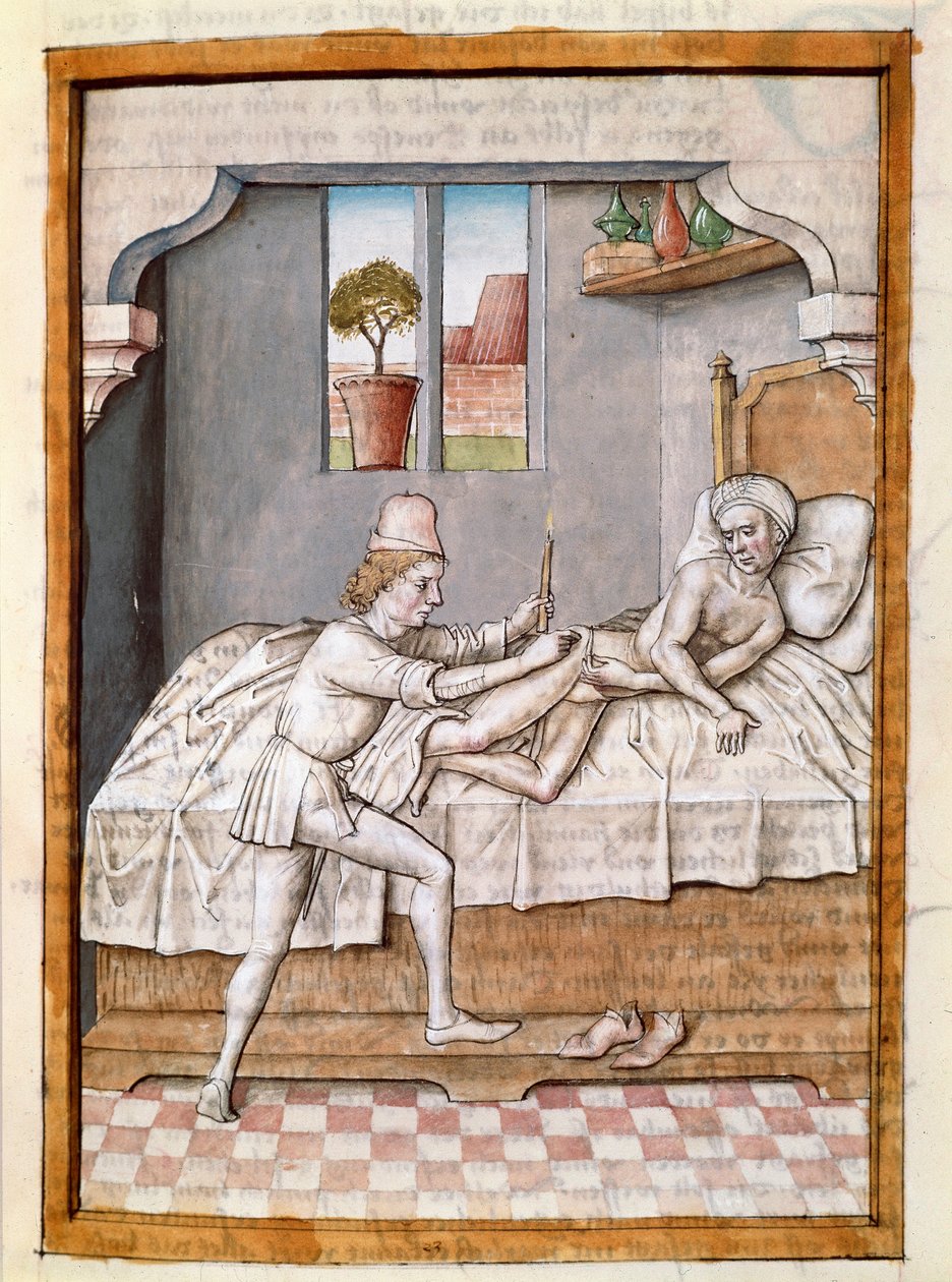Egy orvos miniatűr beteget kezel Bidpai „Kalila (Calila) és Dimna” meséinek német fordításából. (ms. 1389, fol. 23) 1480 körül Chantilly, Museum Conde alkotó: Unknown artist