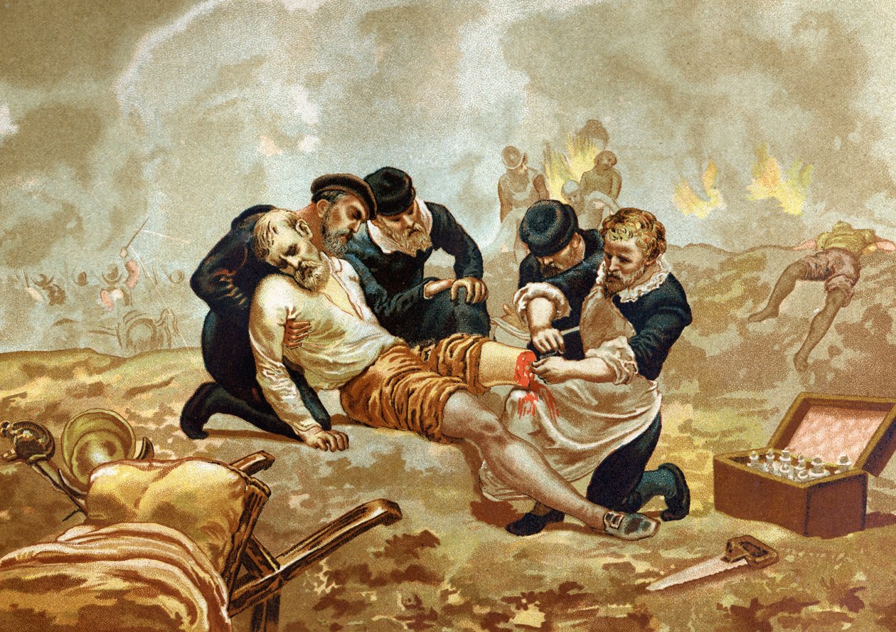 Ambroise Pare Medicine és francia sebész (1509-1590 körül) az artériák amputáció utáni lekötésével foglalkozik. a híres férfiak és nők után. Barcelona 1877. alkotó: Unknown artist