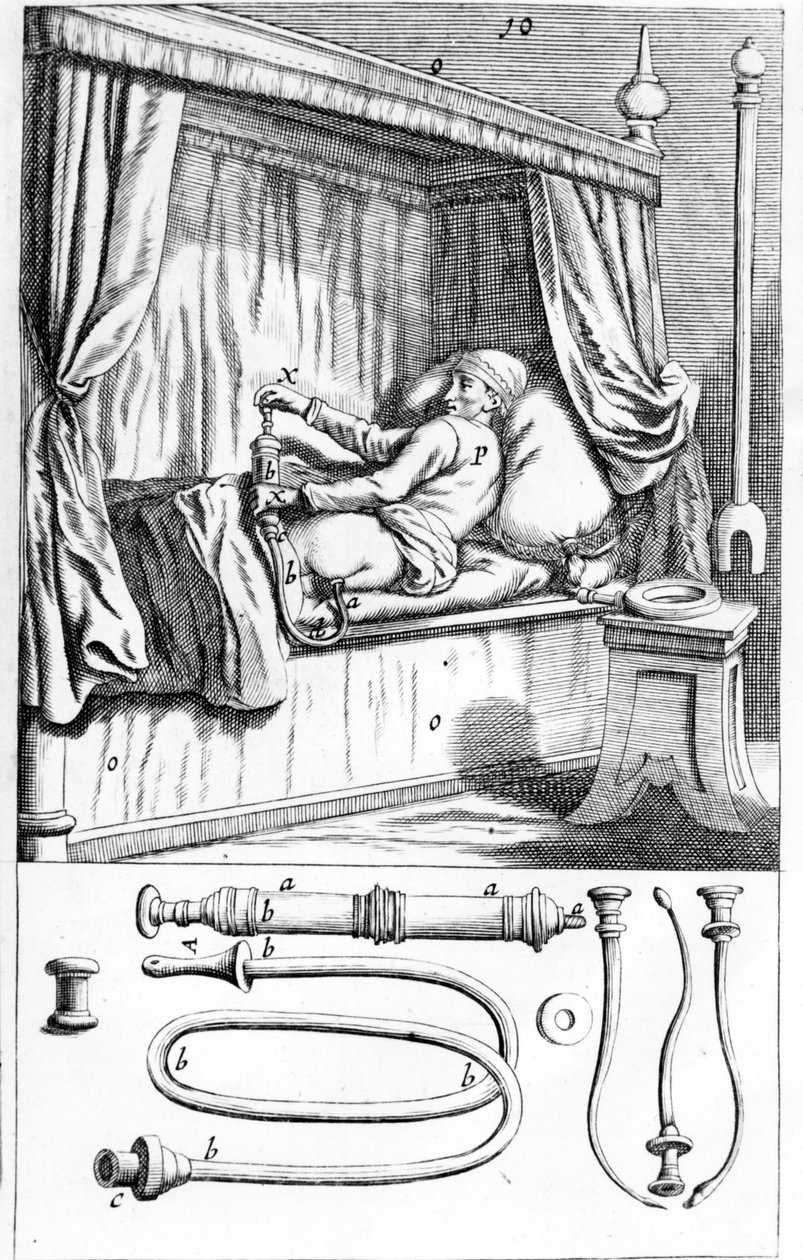 Clystère (beöntésekhez), Johannes Sculptetus „” Armamentarium Surgical””. Velence 1665 alkotó: Unknown artist