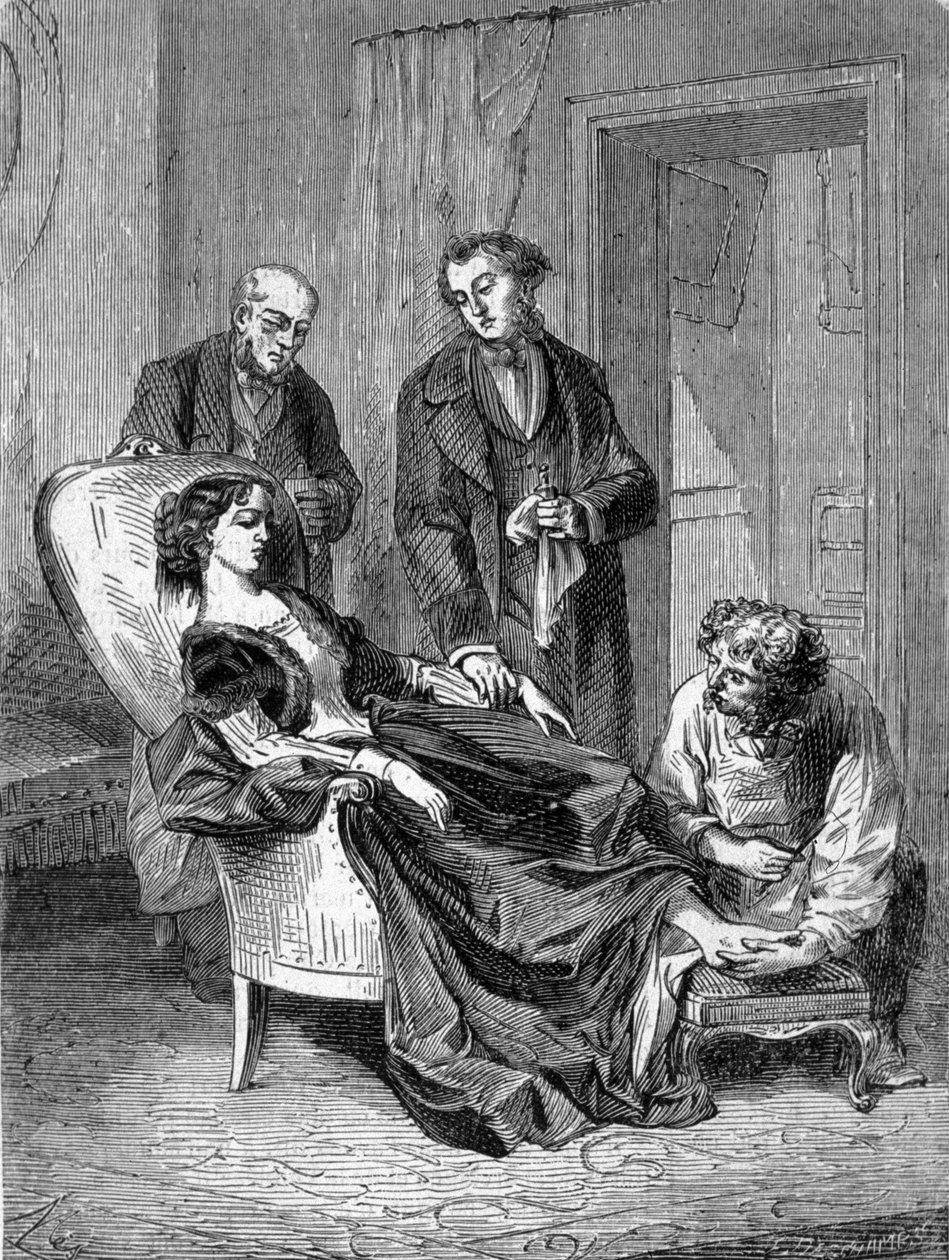 Hannah Greener lány halála tizenöt évesen, az egyik első kloroformos érzéstelenítés után, 1848.01.28-án. Metszet 1869-ből. alkotó: Unknown artist