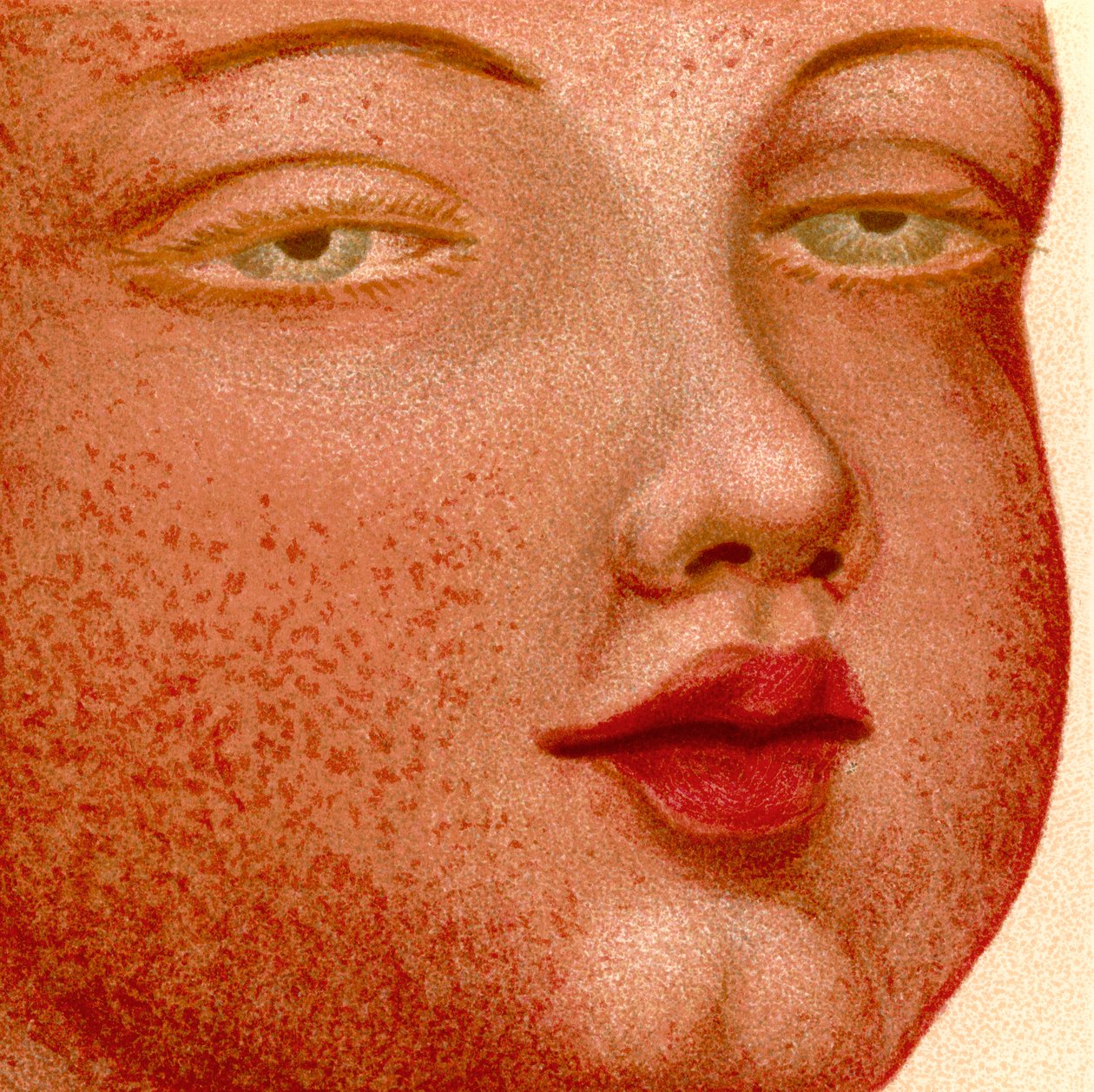 Eruptív láz: Scarlatina vagy skarlát alkotó: Unknown artist