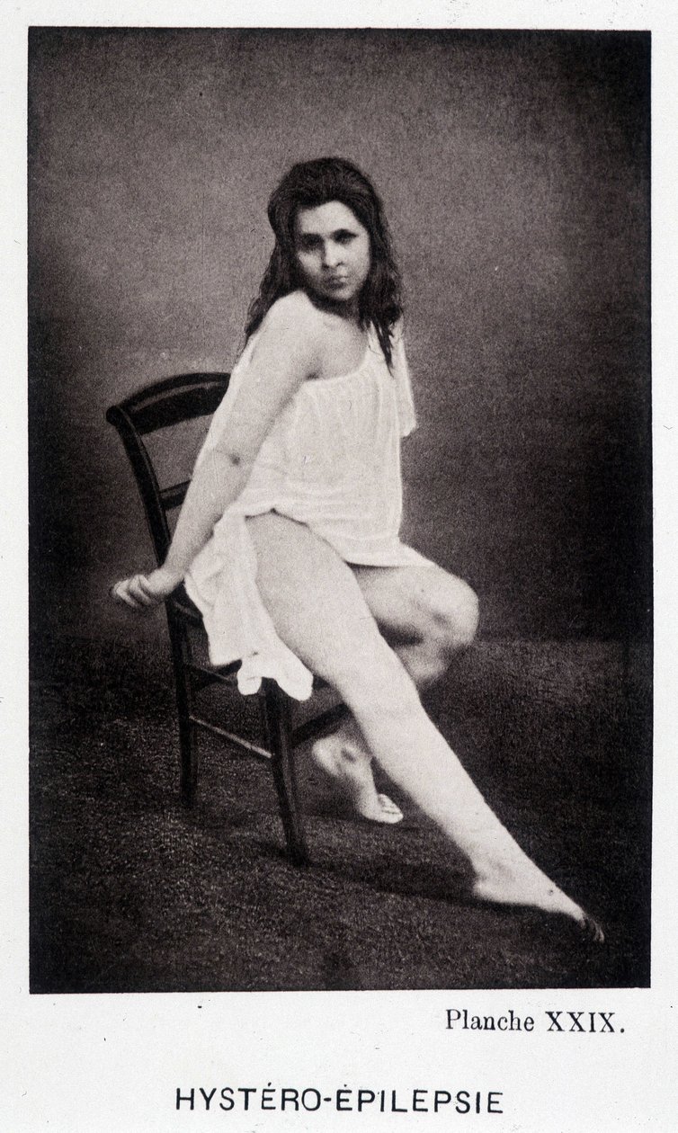 Hystero Epilepsia – kontraktúra a Salpétrière fényképészeti ikonográfiájában: Mr. Charcot szolgálata, Paul Regnard és Bourneville alkotó: Unknown artist