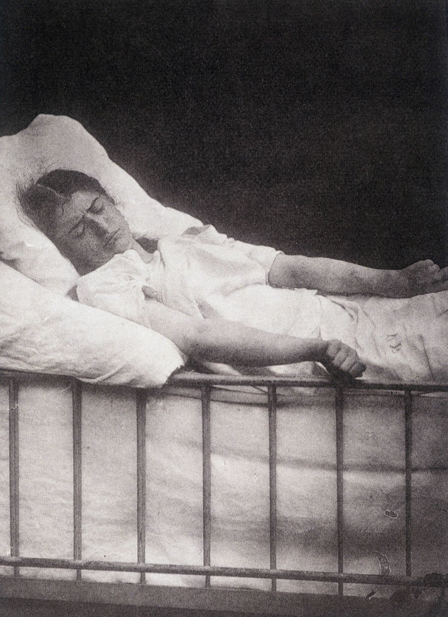 Hystero Epilepsia – Tetanizmus támadás a „Salpétrière fényképes ikonográfiájában: Mr. Charcot szolgálata” Paul Regnard és Bourneville alkotó: Unknown artist