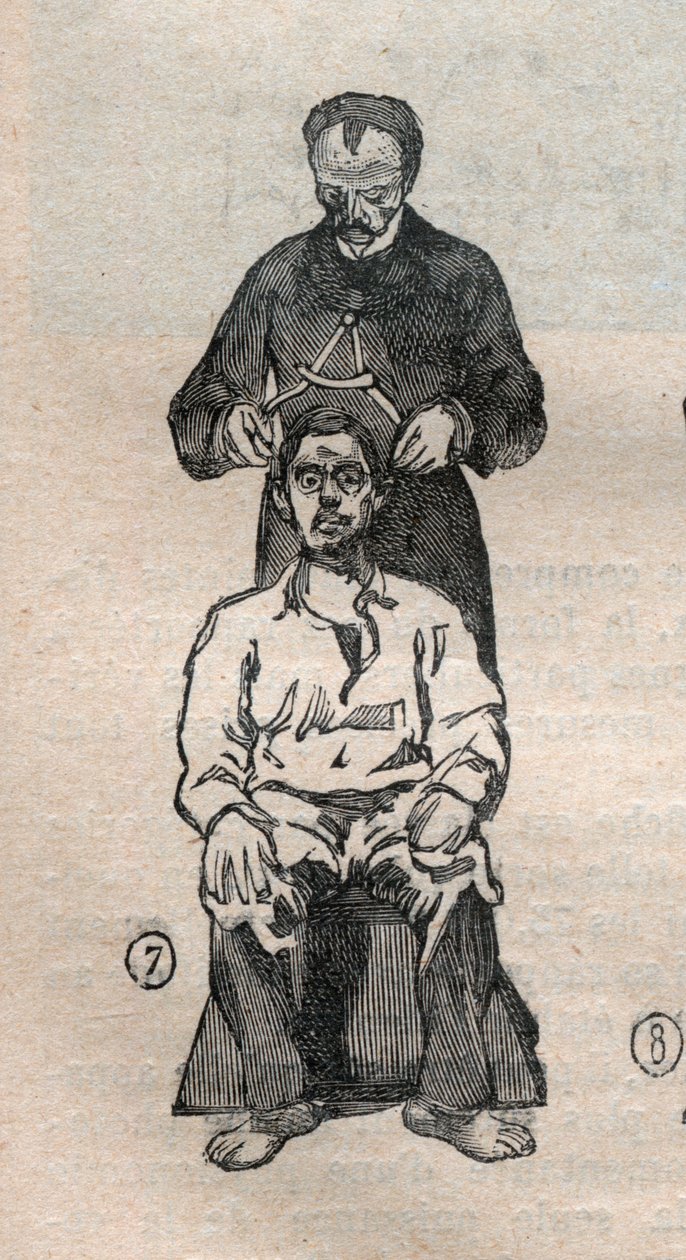 Bírói antropometria vagy bertillonnage, Alphonse Bertillon (1853-1914) módszere: a koponya keresztirányú átmérőjének mérése - Gravírozás „” La Science francaise”-ban alkotó: Unknown artist