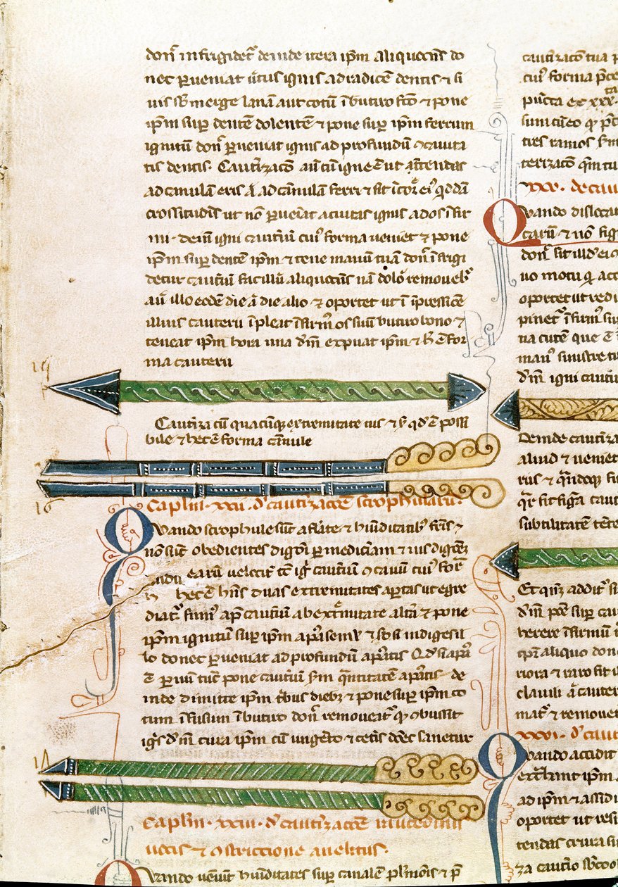 Guillaume de Salicet (Guglielmo da Saliceto) (1207-1270) szerzetes és orvos kéziratos oldala: „” Sebészet”” (MS. LAT.VII XXXII-3023). 14. századi Biblioteca Marciana Velence alkotó: Unknown artist