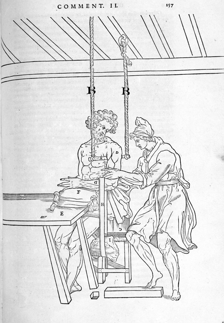 A törések csökkentése. Carlo Stefano Riverio "Az emberi test boncolása három részre..." című táblája, Párizs 1545 alkotó: Unknown artist