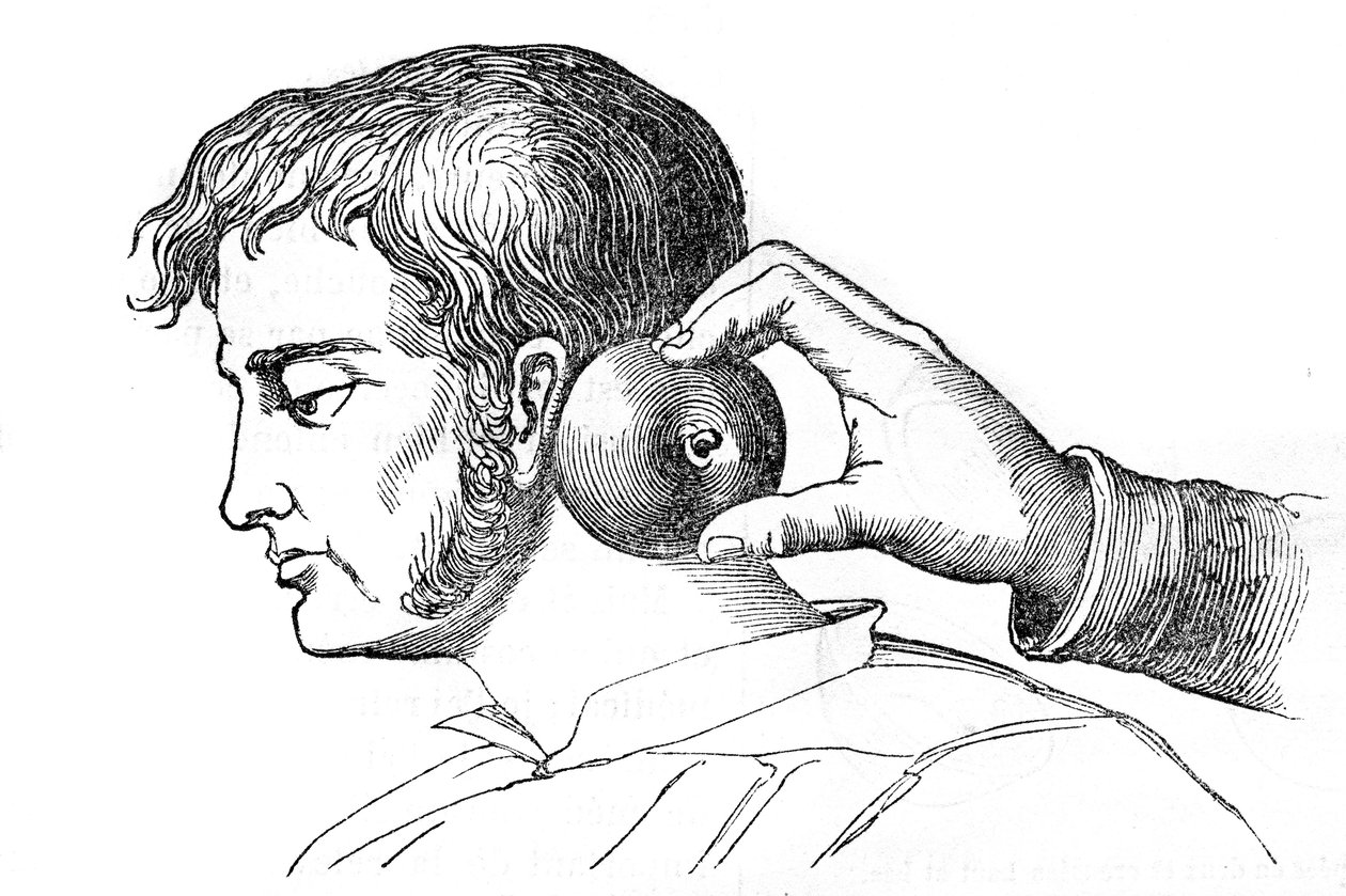 Saignee locales – piócák alkalmazása almával – gravírozás a „La Santo Universelle – Medical Guide for Families”-ben, 1852 alkotó: Unknown artist
