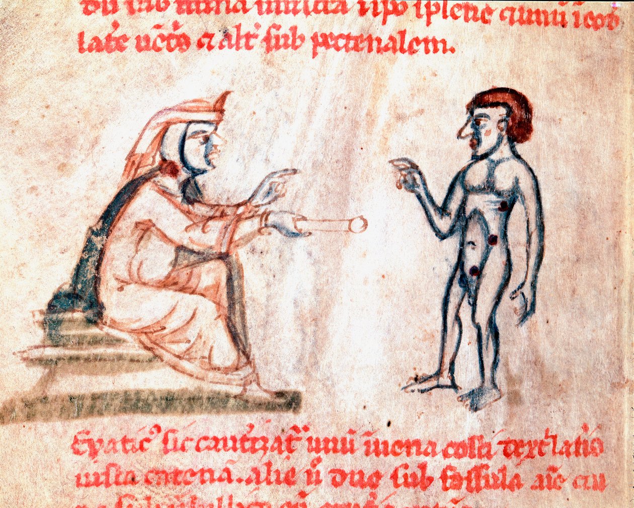 Az orvos megégeti a pácienst a fájdalmas területeken forró vasalóval Miniatűr a „” De Medicina cauteriorum secundum Brunum, Rugerium et Rolthe” kéziratból, 13. század Párizs, B.N. alkotó: Unknown artist