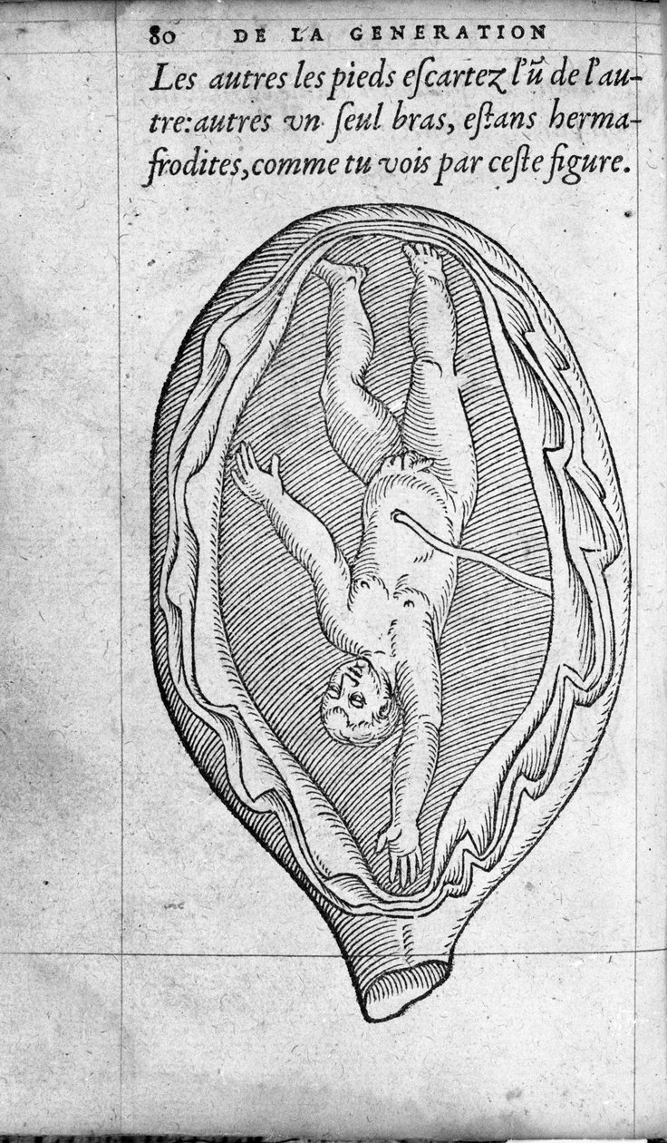 A magzat helyzete a méhben a terhesség alatt. Ambroise Pare francia orvos és sebész (1509-1590) „De la Generation des enfants” című metszete XVI. alkotó: Unknown artist