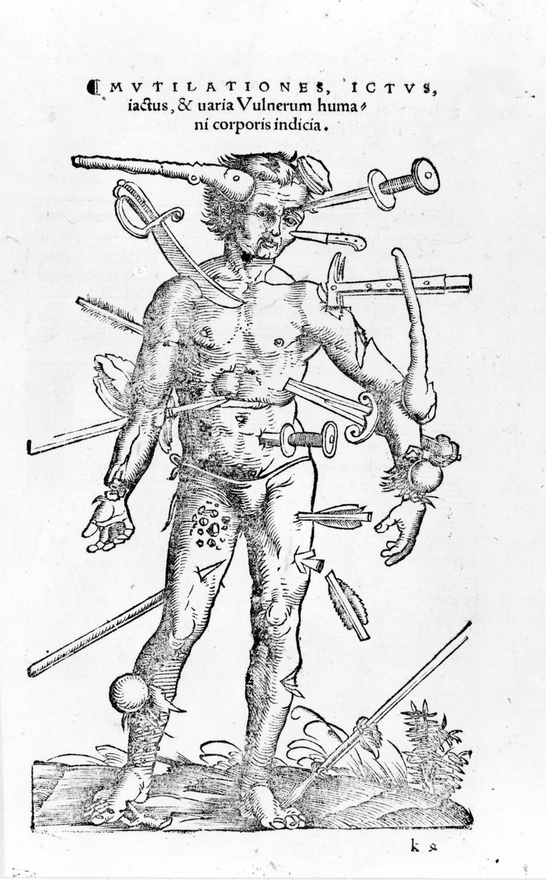 Mindenféle traumatikus háborús sérülés. 16. század alkotó: Unknown artist