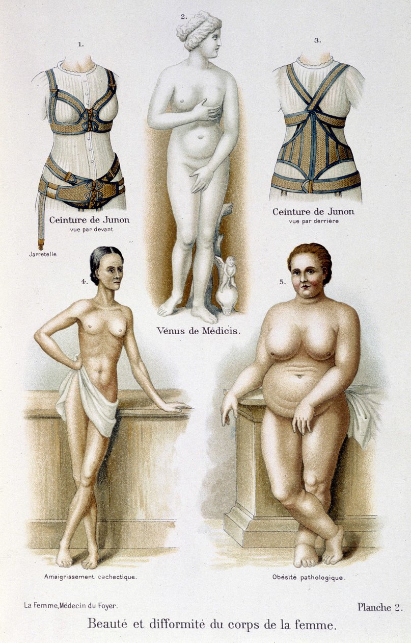 A női test szépsége és deformitása (soványság és elhízás); Juno övei – A nő, házi orvos alkotó: Unknown artist