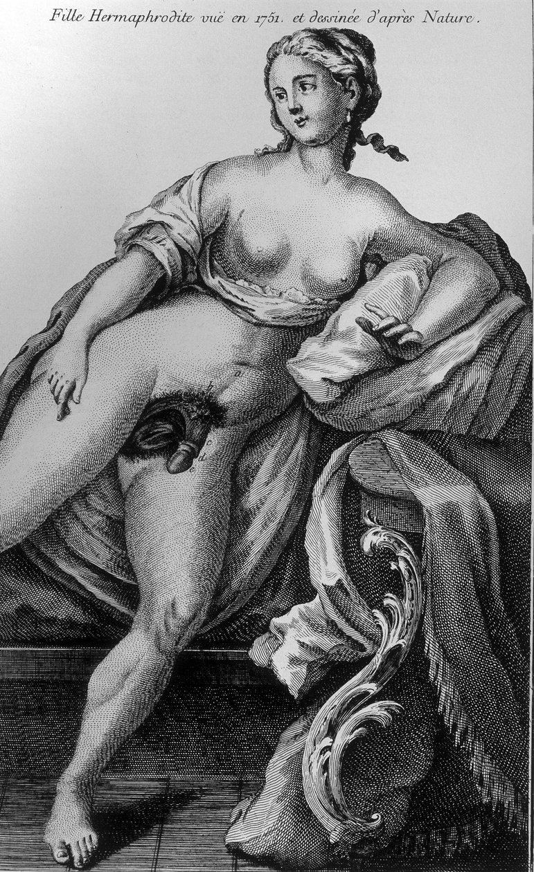Hermafrodita lány 1751-ben, és a természetből merítették. alkotó: Unknown artist