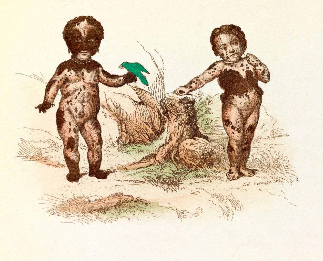 Szőrös foltokkal borított kislány (metszet) alkotó: Unknown artist