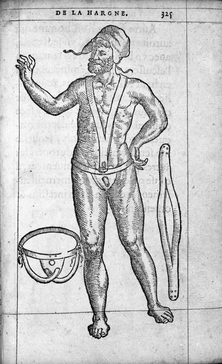 Gyógyszer: herniális öv. Ambroise Pare francia orvos és sebész (1509-1590) metsze „De la hargne”-ból, XVI. alkotó: Unknown artist