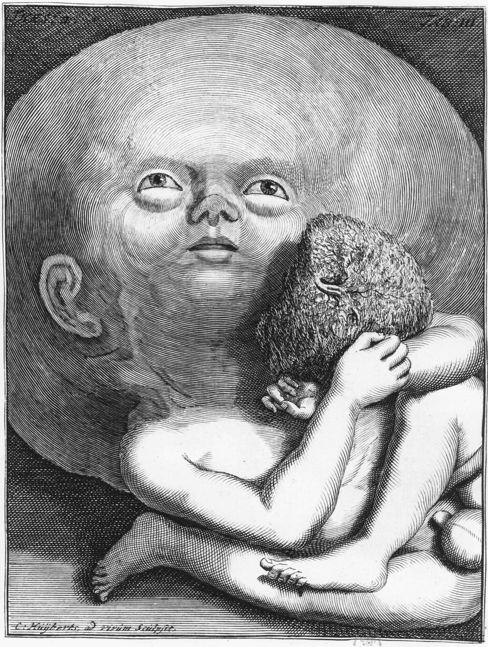 Szörny: Child hydrocephalus antropológia – sír, a.n.d., 18. század vége alkotó: Unknown artist