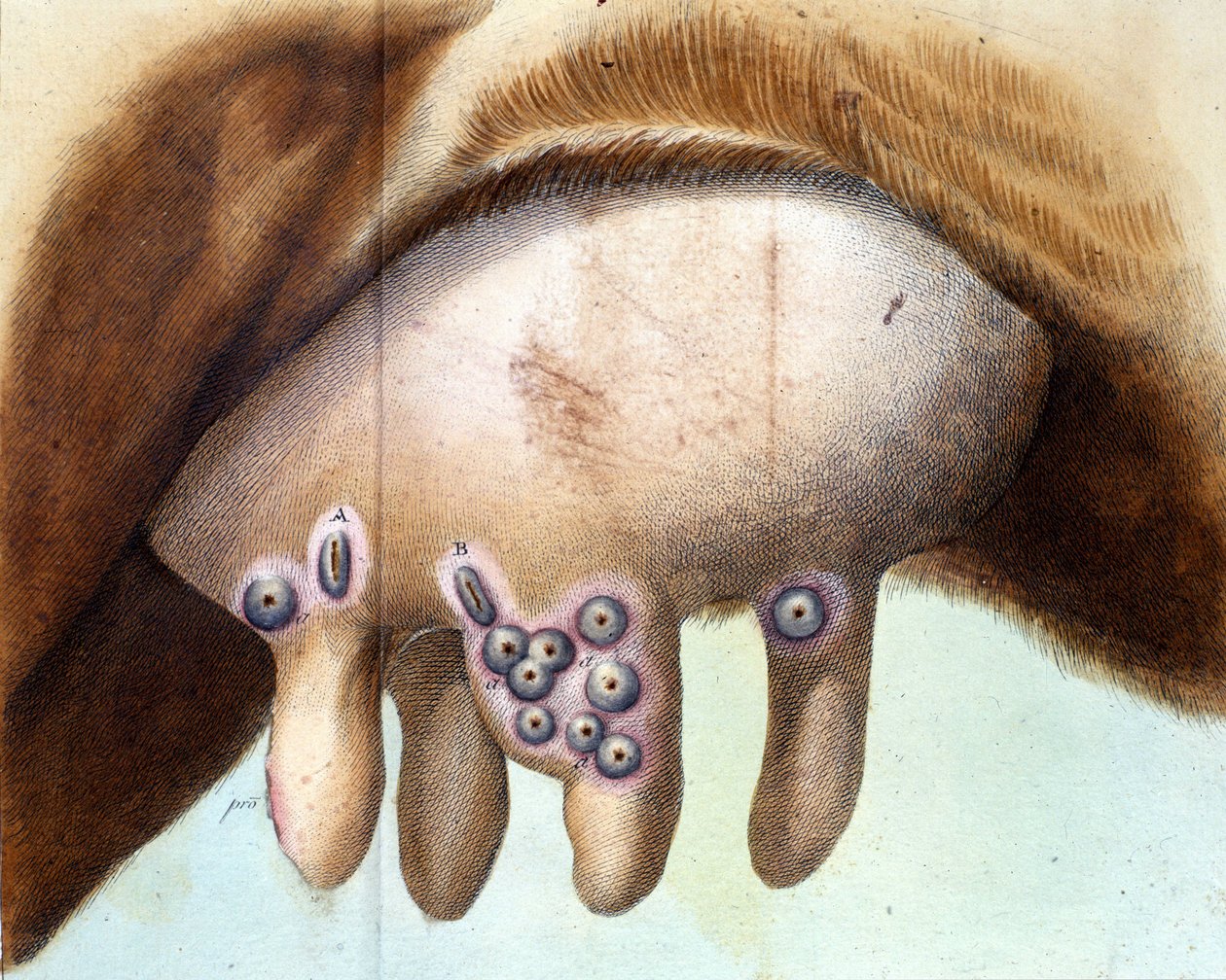 A Luigi Sacco (1769-1836) himlőoltás beoltására használt tehénmell 1801 januárjában. Orvosi lemez a „” Vaccination Treat”-től, Luigi Sacco, Milánó alkotó: Unknown artist