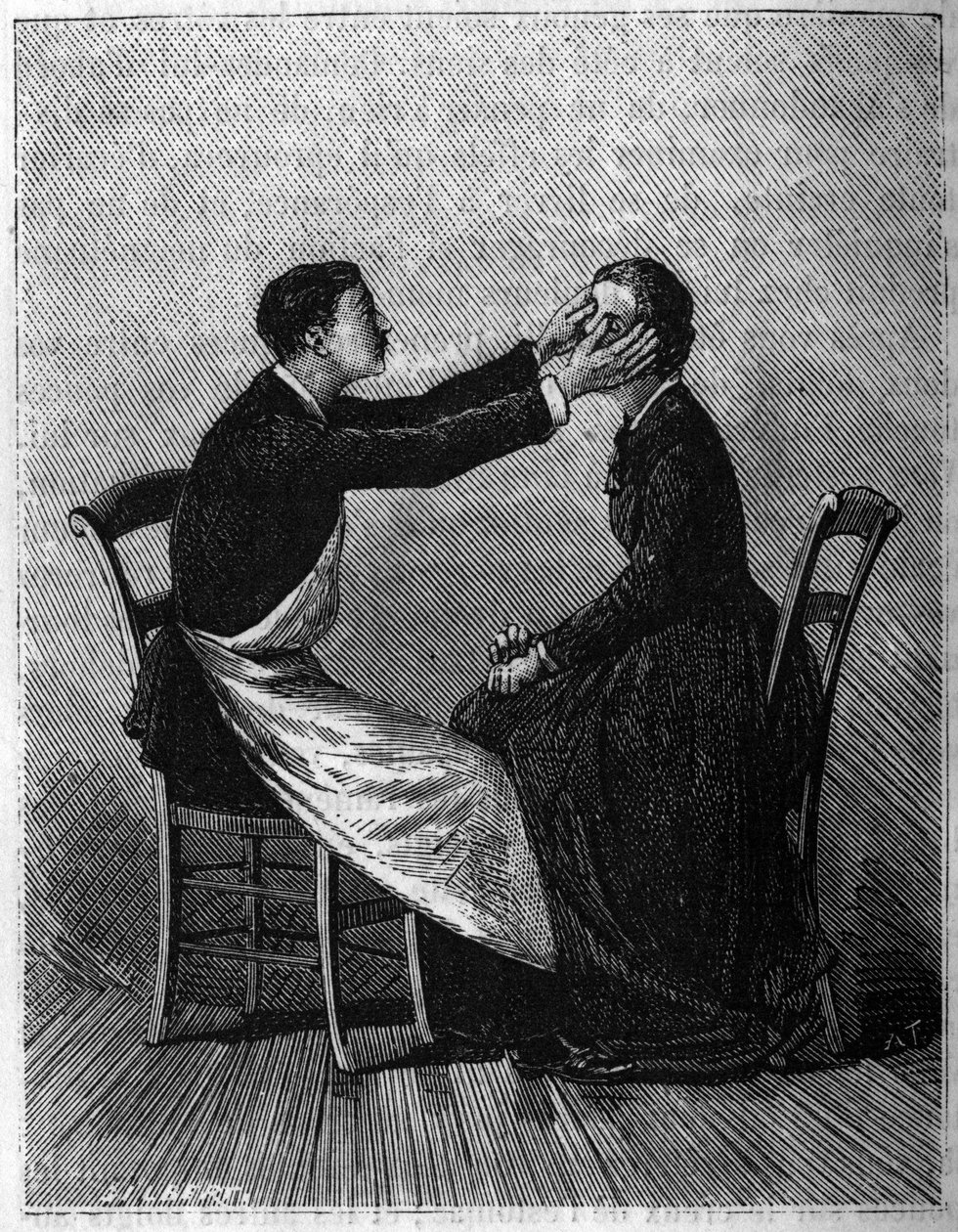 A hipnózis jelenségei: A hipnotikus alvás meghatározásának módja. alkotó: Unknown artist