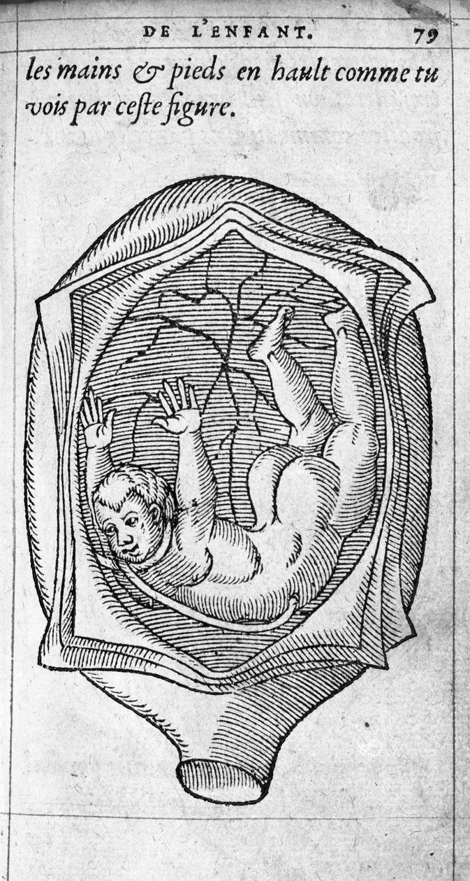 A magzat helyzete a méhben a terhesség alatt. Ambroise Pare francia orvos és sebész (1509-1590) „De la Generation des enfants” című metszete XVI. alkotó: Unknown artist