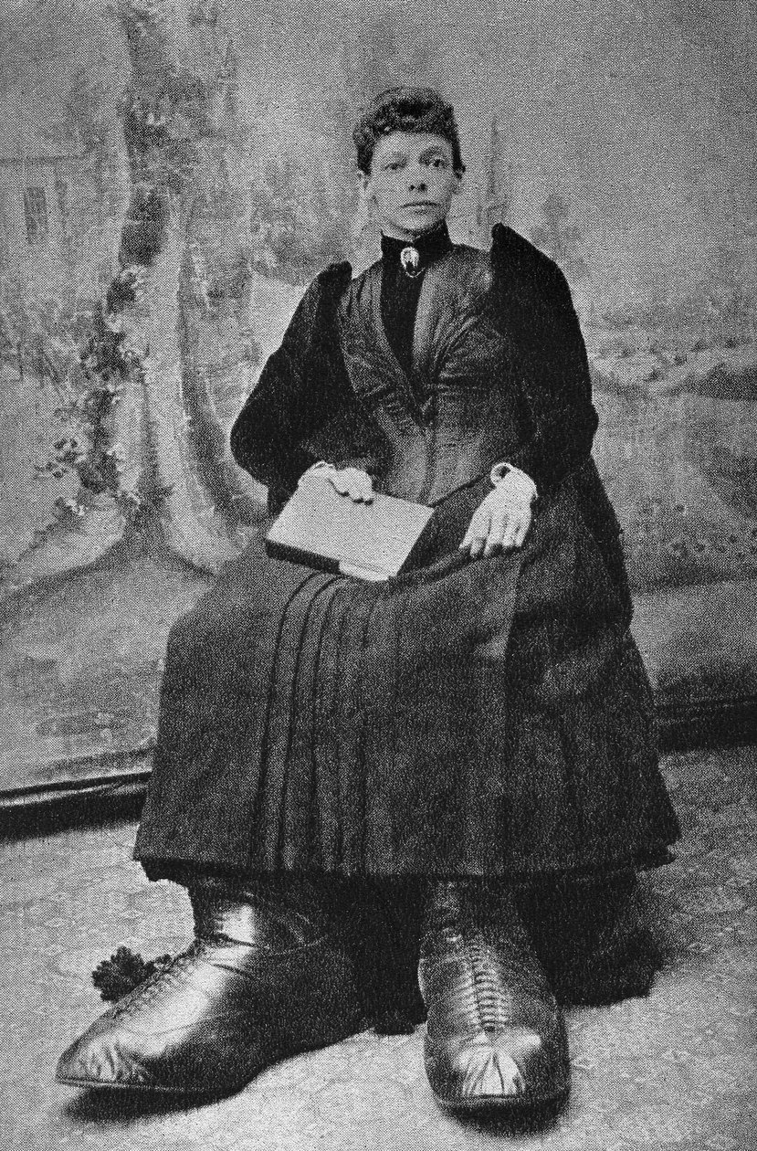 A Szörnyek, Bertha nagy lábbal. Fényképészet, 19. század vége, Párizs. Coll. Selva. alkotó: Unknown photographer