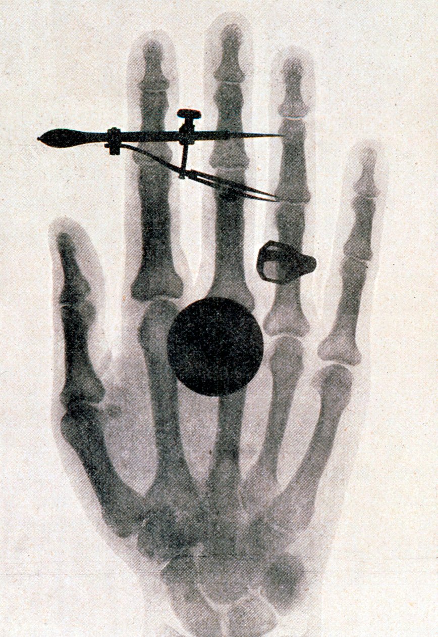 Wilhelm Roentgen röntgenfelvétele felesége kezéről, 1896 alkotó: Wilhelm Conrad Rontgen