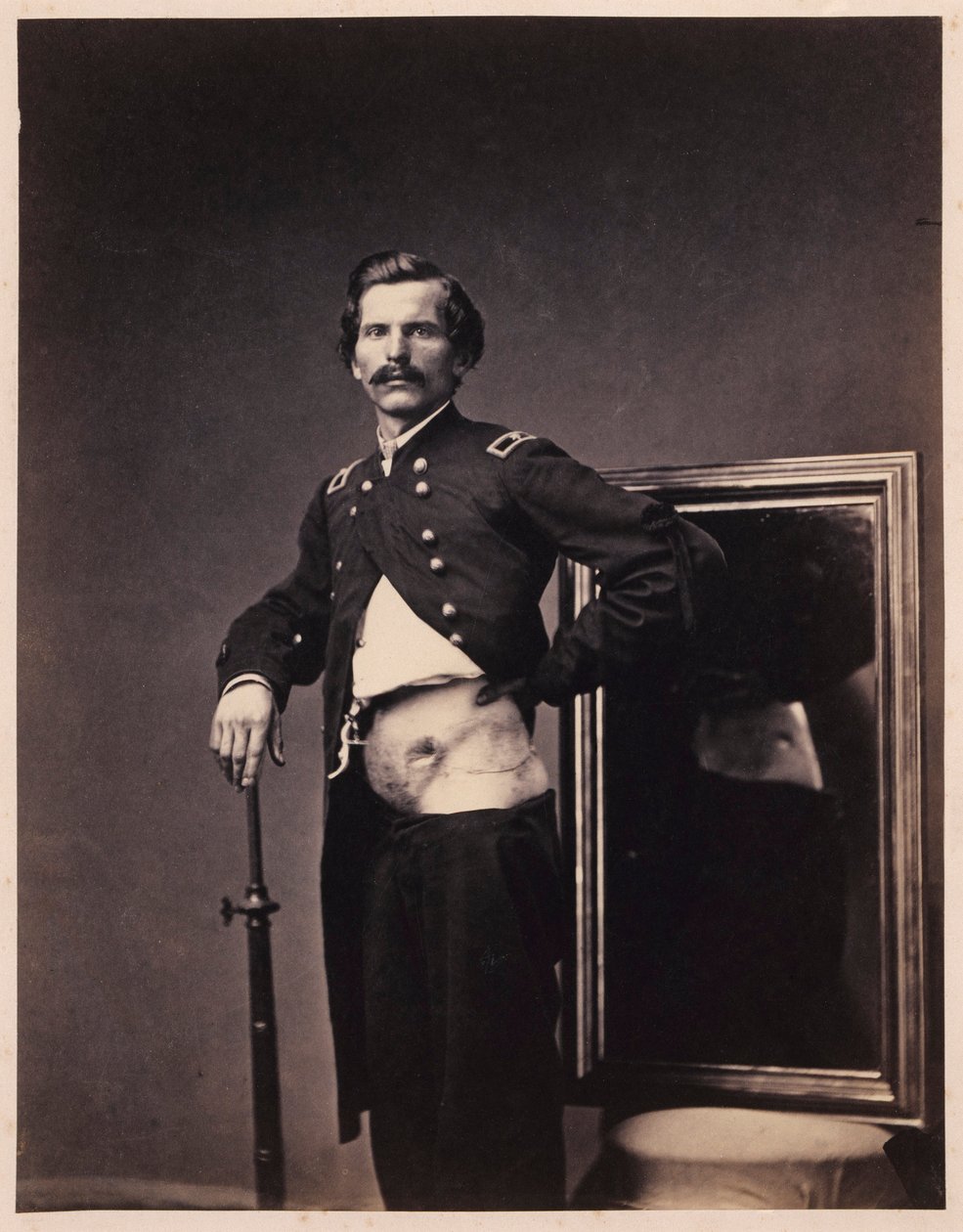 H. A. Barnum őrnagy, felépülés egy hasi lőtt seb után, a bal Ilium perforációjával, a sebészeti részleg fényképkatalógusából alkotó: William Bell