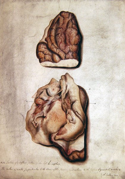 Study of Brain III, 1850 körül (akvarell papíron) alkotó: William Lover