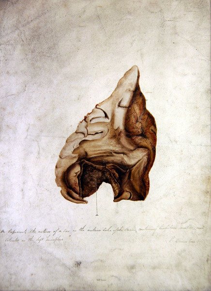 Study of Brain I, 1850 körül (akvarell papíron) alkotó: William Lover
