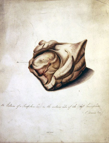 Study of the Brain II, 1850 körül (akvarell papíron) alkotó: William Lover