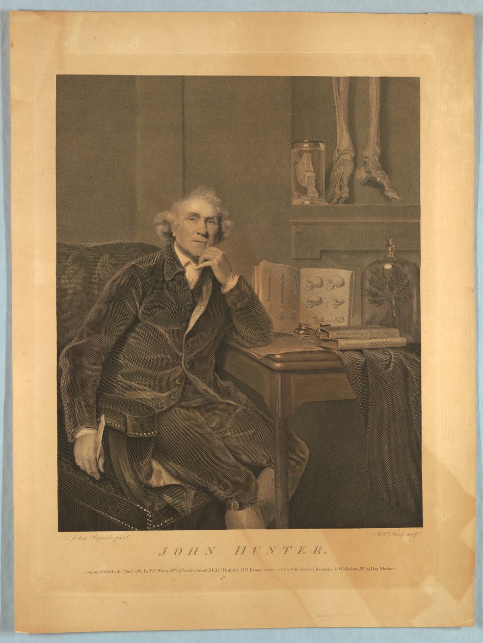 John Hunter portréja alkotó: William Sharp