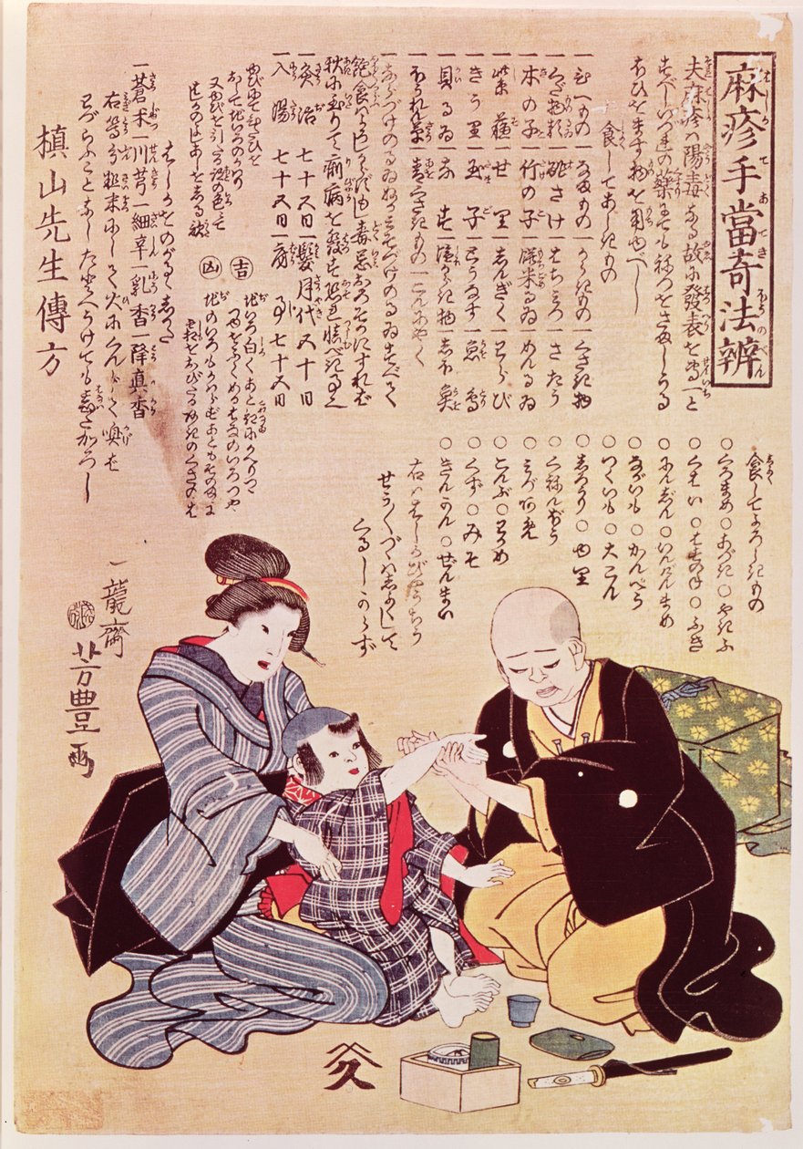 Orvos két kézzel tapintja a gyermek pulzusát a kínai-japán szfimológia szabályai szerint. alkotó: Yoshitoyo