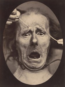 Electro-Physiologie, 64. ábra, 1854-56, nyomtatva 1862.