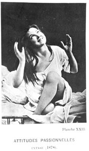 Szenvedélyes attitűdök: Augustine extázisban, Desire Magloire Bourneville (1840-1909) és Paul Regnard (1850-1927) „Iconographie de la Salpetriere” című művéből, 1878 alkotó: Albert Londe
