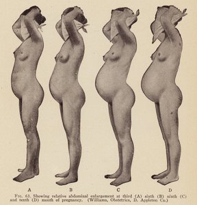 A terhesség jelei és tünetei (fekete-fehér fotó) alkotó: American Photographer