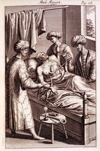 A Medicina Aegyptorum moxibustiójának illusztrációja, Prospero Alpinus, 1745 alkotó: American School