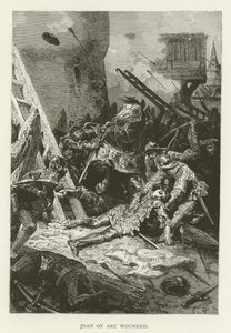 Jeanne of Arc megsebesült alkotó: American School