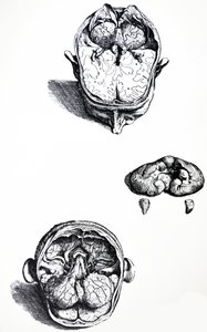A tányérok a De Humani Corporis Fabrica hetedik könyvéből alkotó: Andreas Vesalius