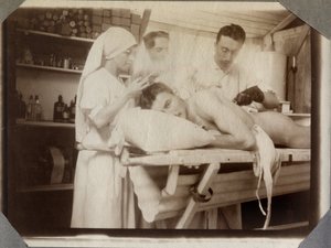 Első világháború 1914-1918: orvosok és ápolónők katona sebesüléseit kezelték az öltözőben, Couville-i tábor a La Manche csatornában, Alsó-Normandia (Alsó-Normandia), Franciaország. Névtelen fénykép 1917. július. Magángyűjtemény, Stella. alkotó: Anonymous Anonymous