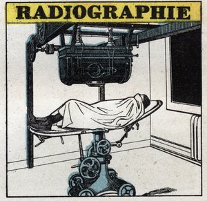 Röntgensugárzás: röntgenkészülék. Névtelen illusztráció 1925-ből. Magángyűjtemény. alkotó: Anonymous Anonymous