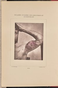 Zóna alkotó: Arthur de Montmeja