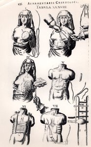 Mellrák műtét, Johannes Schultes (1595-1645) Armamentarii Chirurgici című művéből, Amszterdamban, 1672-ben alkotó: Dutch School